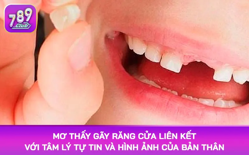Mơ thấy gãy răng cửa liên kết với tâm lý tự tin và hình ảnh của bản thân